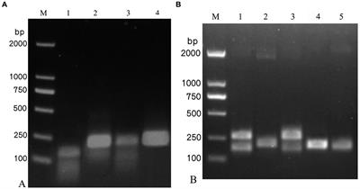 Establishment of a reverse transcription–recombinase polymerase amplification–lateral flow dipstick method for the dual detection of Israeli acute paralysis virus and chronic bee paralysis virus